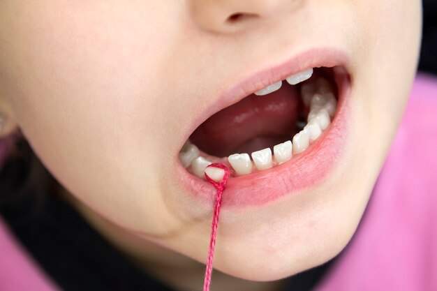 Babies Get Molars teeth