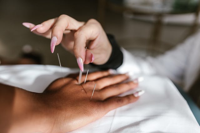 Acupuncture and Fertility